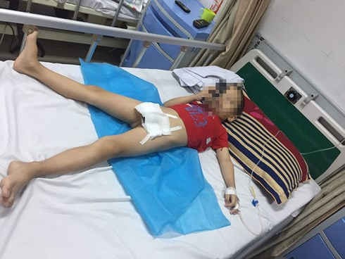 xu phat 100 trieu dong phong kham lay benh bi sui mao ga o tre em hinh 1