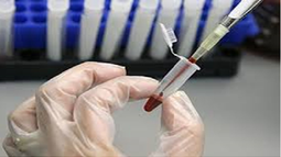 38 bệnh viện trung ương thực hiện liên thông kết quả xét nghiệm từ 01/8/2017